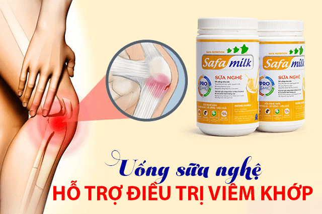 Sữa nghệ chống viêm khớp