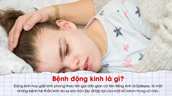 Bệnh động kinh là gì?