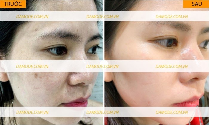 Tất Tần Tật Các Thông Tin Damode Beauty Reviews Đáng Tin Cậy Nhất Damode Dầu gội