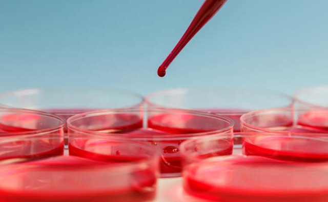 Deep Learning là gì ? Ứng dụng của Deep Learning Deep Learning là gì ? Ứng dụng của Deep Learning