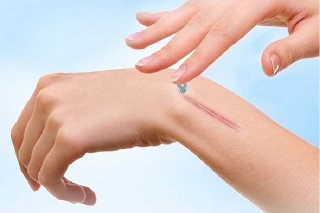 Top những loại kem trị sẹo Nga tốt nhất được tin dùng Top những loại kem trị sẹo Nga tốt nhất được tin dùng