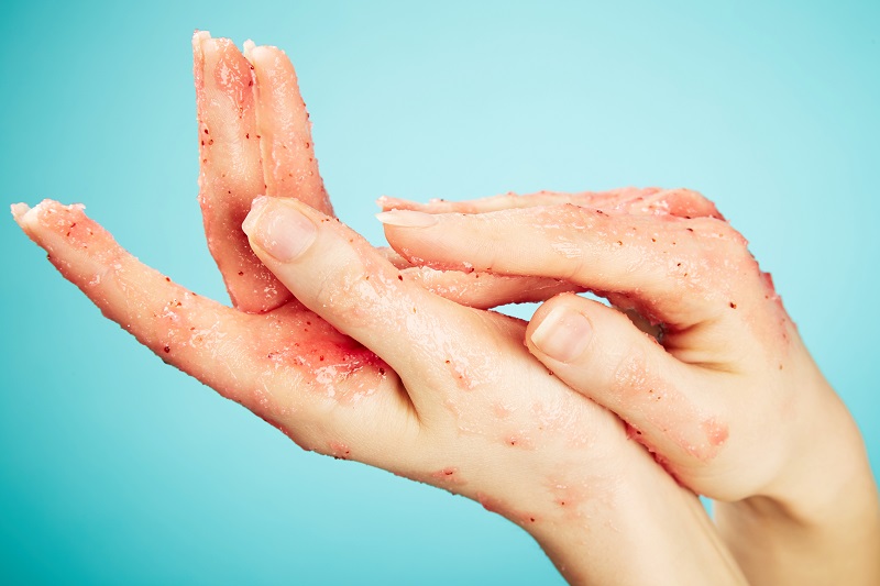 Top những kem tẩy tế bào chết toàn thân tốt nhất