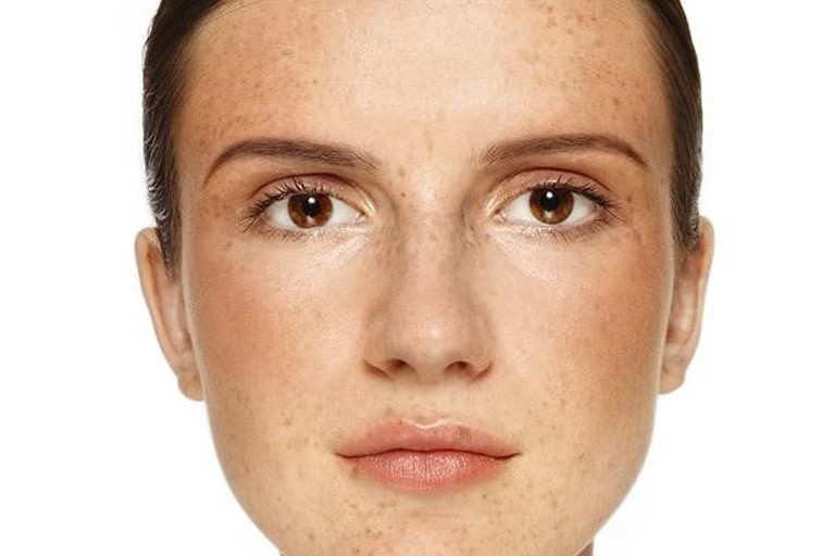 Lão hóa da là gì? Làm gì để cải thiện