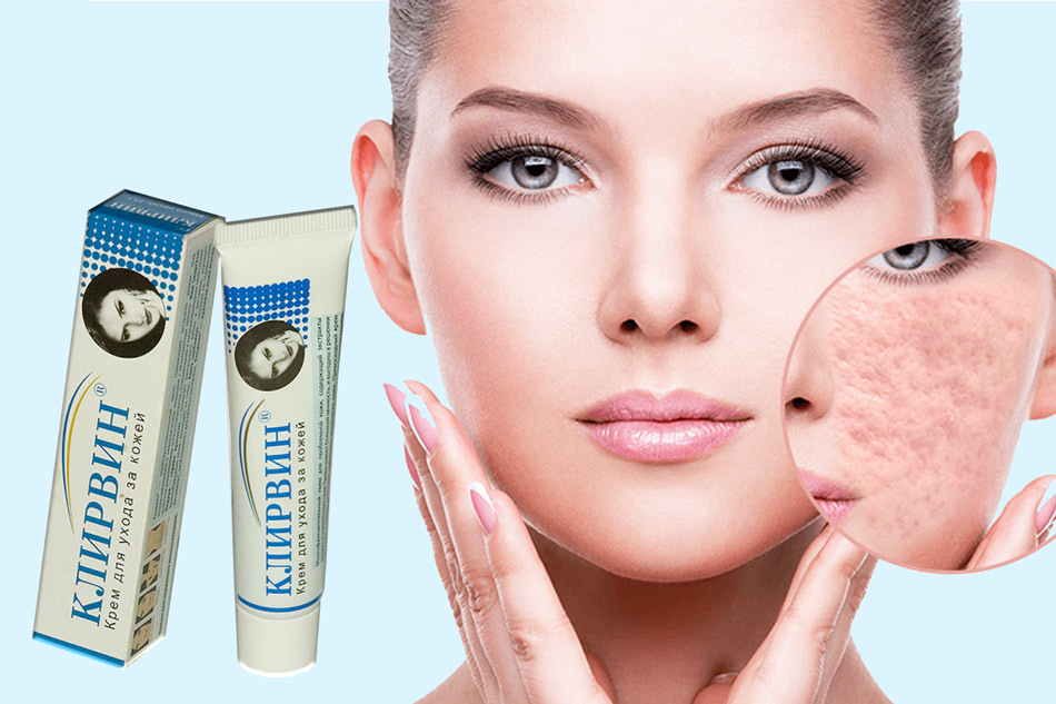 Top những loại kem trị sẹo Nga tốt nhất được tin dùng kem trị sẹo nga loại tốt