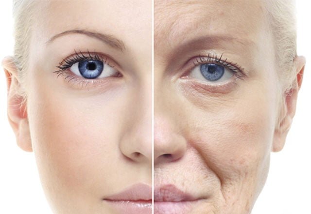 Nguyên nhân khiến da bị lão hóa. Biện pháp cải thiện Nguyên nhân khiến da bị lão hóa