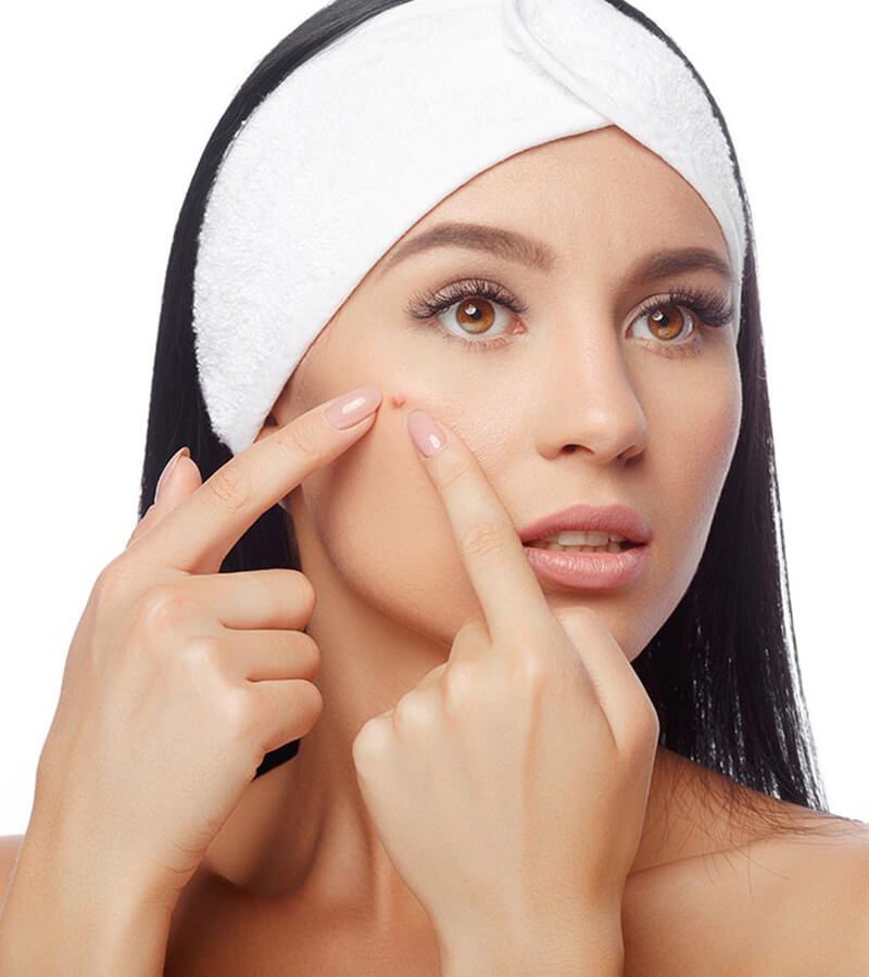 Bị mụn không nên làm gì? Cần tránh ngay để giảm mụn