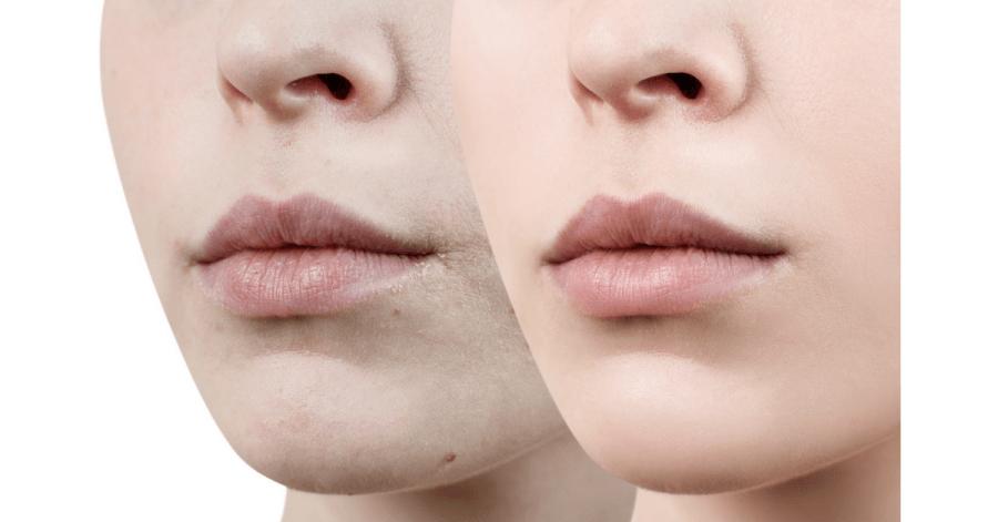 Kinh nghiệm chọn son cho môi thâm